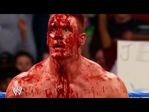 شاهد أخطر 10 إصابات حقيقية في مباريات مصارعة wwe